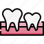 dentistry, dental care, dentist, medical, tooth, tooth milk, teeth, gum 