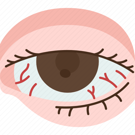 Infection, eye, injury, conjunctivitis, allergy icon - Download on Iconfinder