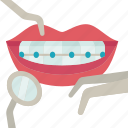 orthodontics, braces, dental, treatment, beauty