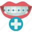 orthodontics, treatment, dentistry, clinic, care 