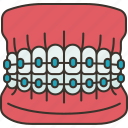 orthodontic, model, bracket, brace, dentistry