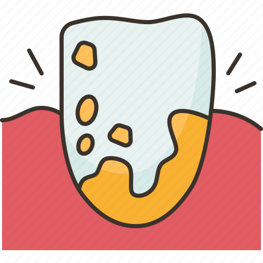 Plaque, teeth, tartar, dental, hygiene icon - Download on Iconfinder