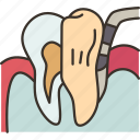 periodontal, inflammation, gums, teeth, disease