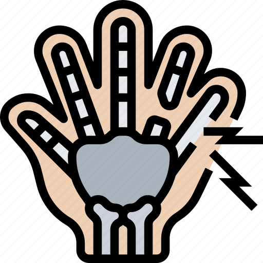 Hand, finger, broken, fracture, xray icon - Download on Iconfinder