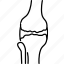 osteoarthritis, knee, arthritis, bone 