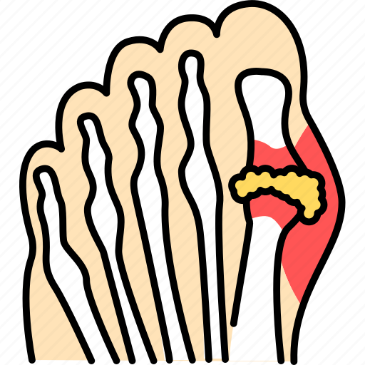 Gout, feet, bone icon - Download on Iconfinder on Iconfinder