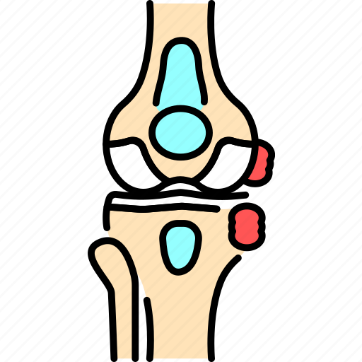 Infectious, knee, arthritis icon - Download on Iconfinder