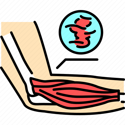 Muscle, joint, elbow, tendonitis icon - Download on Iconfinder
