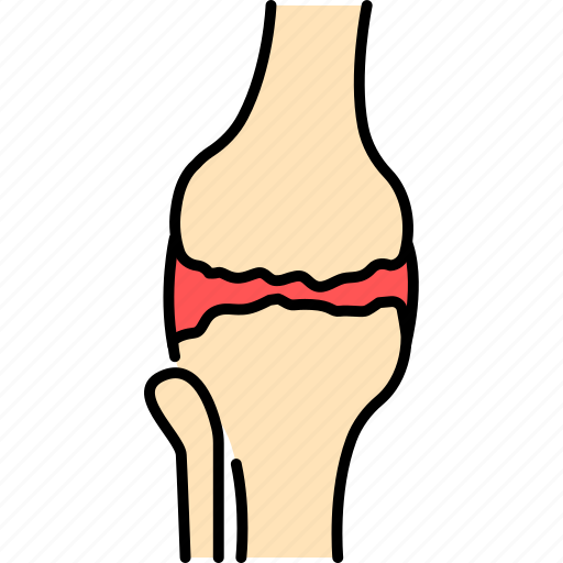 Osteoarthritis, knee, arthritis, bone icon - Download on Iconfinder
