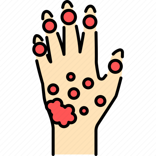 Psoriatic, arthritis, hand icon - Download on Iconfinder
