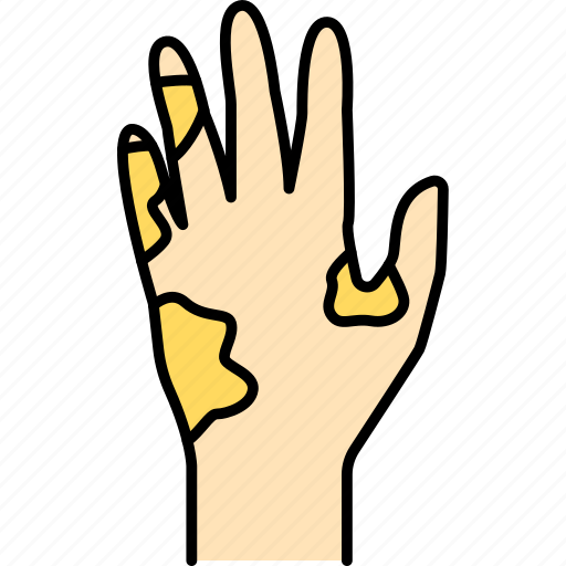 Scleroderma, skin, hand icon - Download on Iconfinder