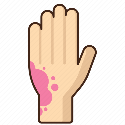 Rash, hand, skin, allergy icon - Download on Iconfinder