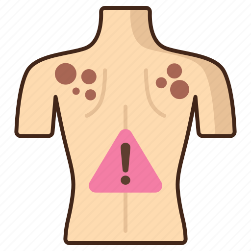 Skin, cancer, rash, dermatology icon - Download on Iconfinder