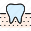 dental, dentist, gum, mouth, stomatology, teeth, tooth 