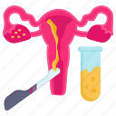 transvaginal, oocyte, retrieval, ivf, test tube baby, procedure, semen 
