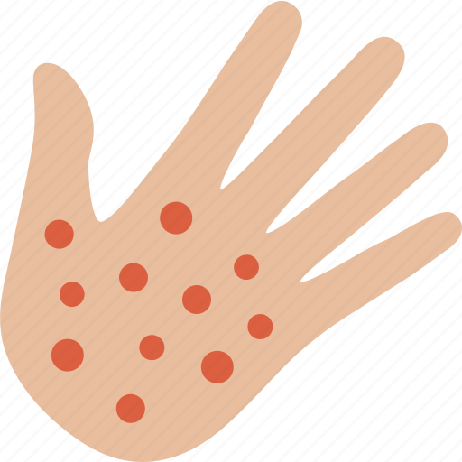 Hand, pox, monkeypox, monkey pox, chicken pox, blisters, disease icon - Download on Iconfinder