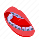 woman, tooth, braces, isometric