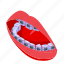 woman, tooth, braces, isometric 