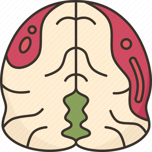 Brain, hemorrhages, neurological, bleeding, cerebral icon - Download on Iconfinder